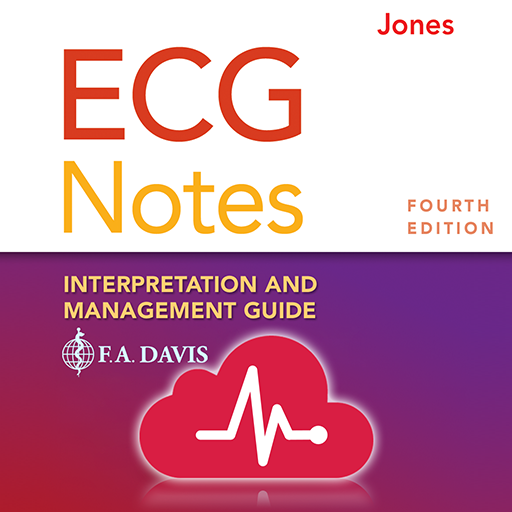ECG Notes