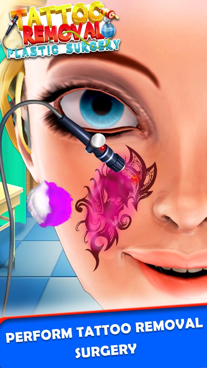 Tattoo Removal Plastic Surgery